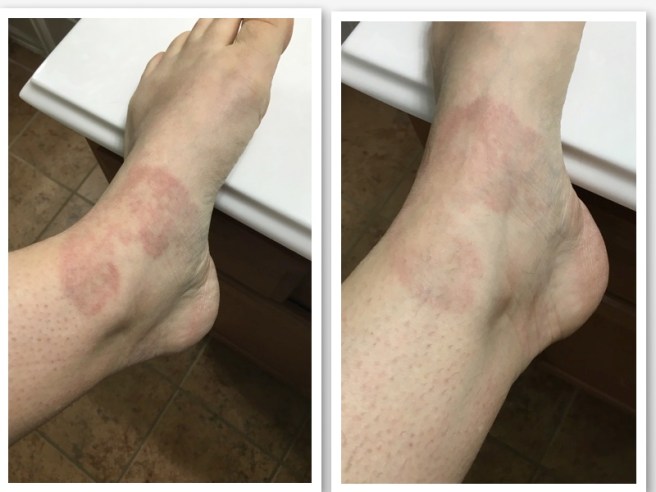 Week 1, Week 7 compare JPG